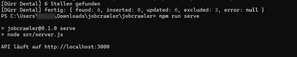 PowerShell: npm run serve startet die API auf localhost:3000